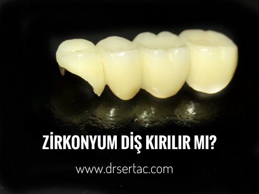 Diş Hekimi Sertaç Kızılkaya tarafından yeniden yapılmış.