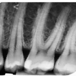 Diş Panoramikrontgen