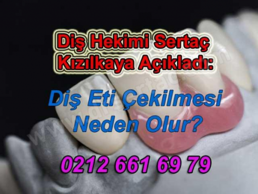 Dişeti Çekilmesi